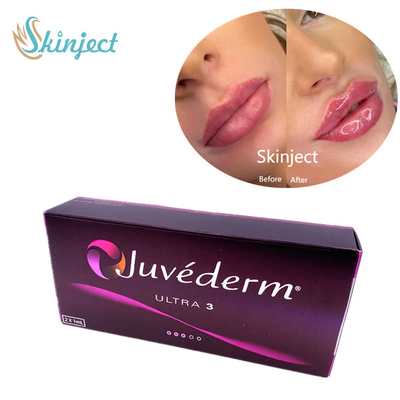 Hyaluronic όξινα του προσώπου υλικά πληρώσεως Juvederm Ultra3 2x1ml δερμικά