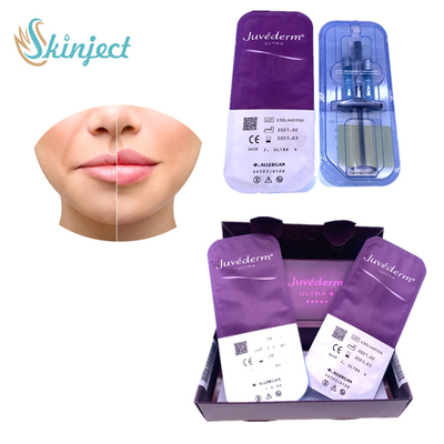 Juvederm Ultra4 Hyaluronic οξύ υλικών πληρώσεως χειλικής διεύρυνσης δερμικό