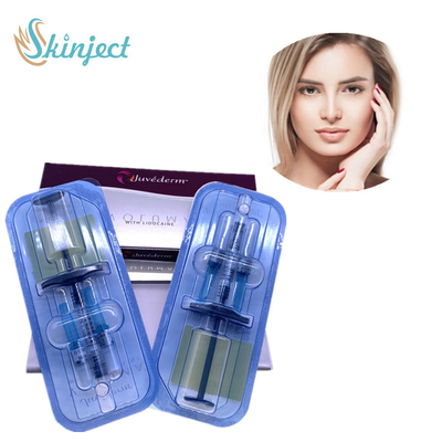 Εκχύσιμες δερμικές αντι ρυτίδες Juvederm Voluma υλικών πληρώσεως για το μάγουλο