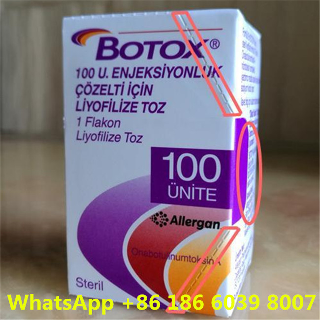 Botulinum τύπος  Allergan μια τοξίνη για τα αντι προϊόντα γήρανσης δερμάτων