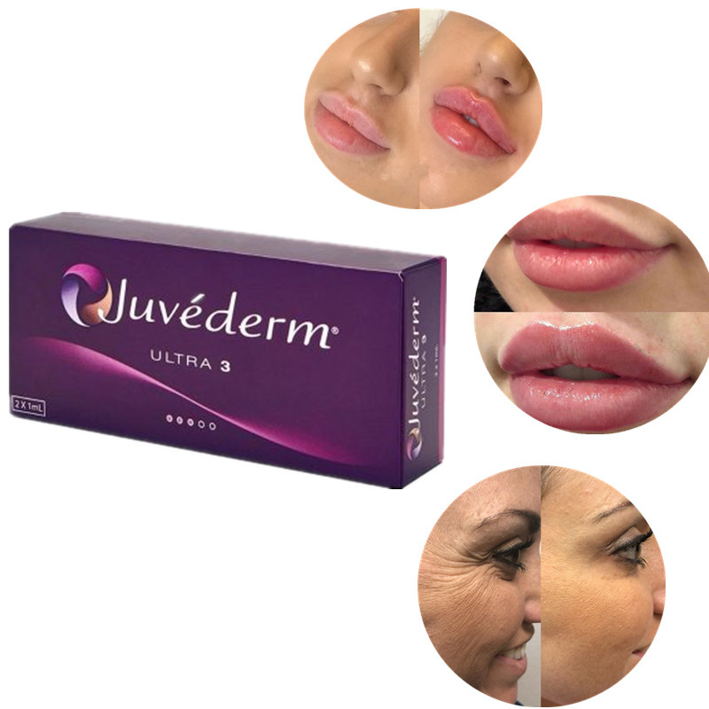 Το χρηματοκιβώτιο διασύνδεσε το δερμικό Hyaluronic όξινο υλικό πληρώσεως για όλους τους τύπους δερμάτων