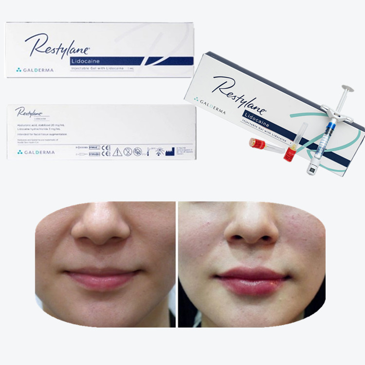 Injectable Dermal Filler HA Fillers Injection for Face Anti-Aging