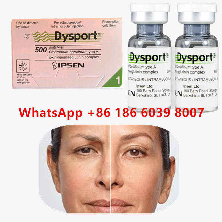 Μπότουλινική τοξίνη Dysport 100u Clostridium Botulinum Type A Για το πρόσωπο Αντιγήρανση ρυτίδες