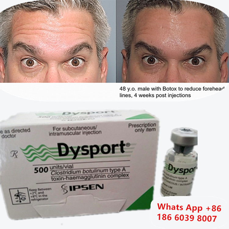 Τοξίνη Βοτουλινικής Dysport Botox Clostridium Botulinum Τύπου Α για Ανύψωση Φρυδιών