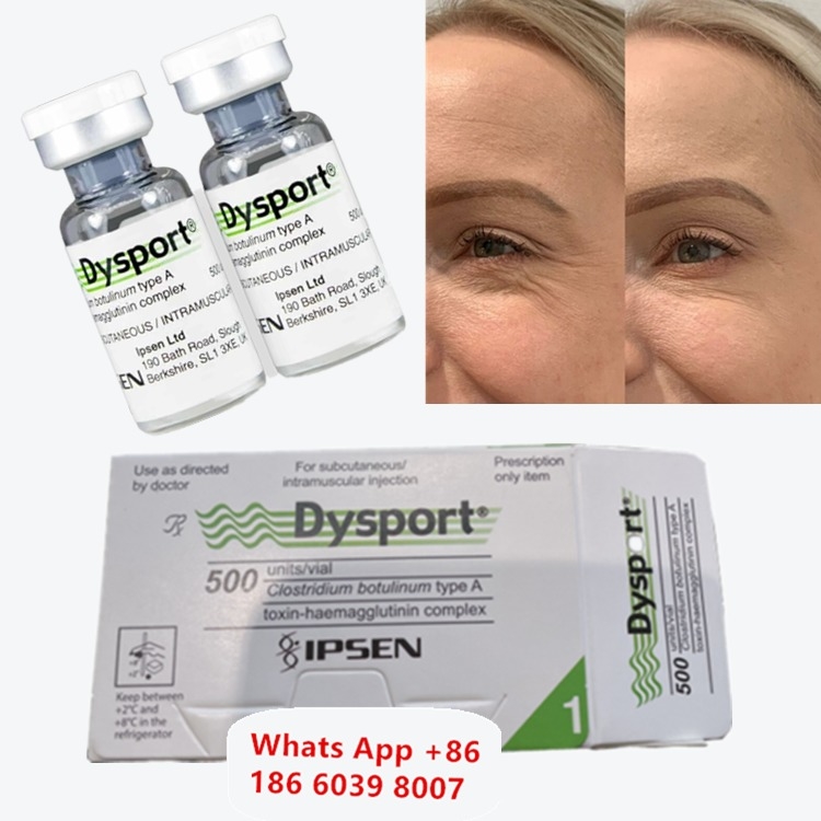 Dysport Βοτουλινική Τοξίνη Τύπου Α για Ρυτίδες της Κοιλάδας των Δακρύων