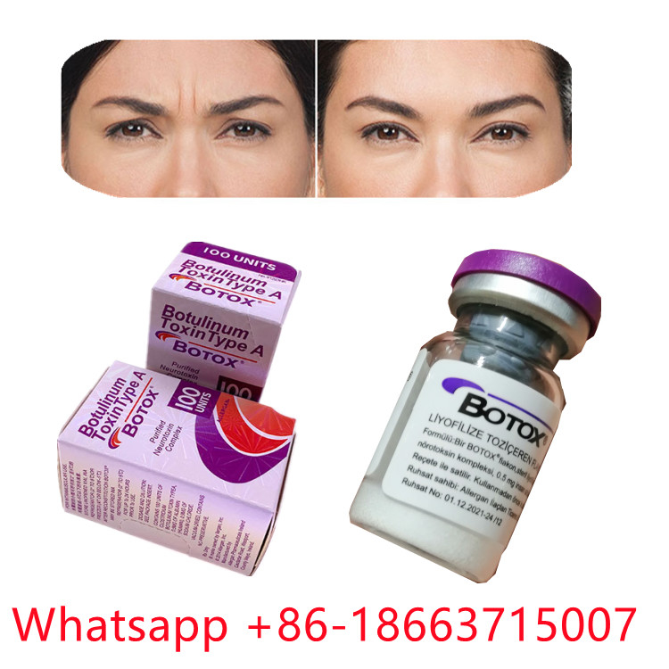 Η Botulinum τοξίνη Allergan δακτυλογραφεί μια μορφή σκονών