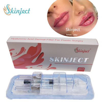 Βαθιά Hyaluronic όξινα δερμικά 2ml χειλικά υλικά πληρώσεως Skinject εκχύσιμα