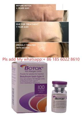 Botox 100IU Allergan Μονάδες Σκόνη Διάλυμα Ενέσεις Botulax Τοξίνη Βοτουλισμού Αφαίρεση Ρυτίδων