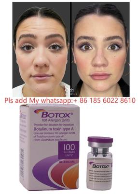 Botulax Τοξίνη Βοτουλινικής Δυσπορτ Allergan Botox για Μείωση Ρυτίδων και Κοσμητική